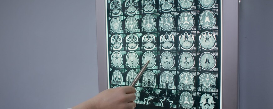 МРТ головы и головного мозга
